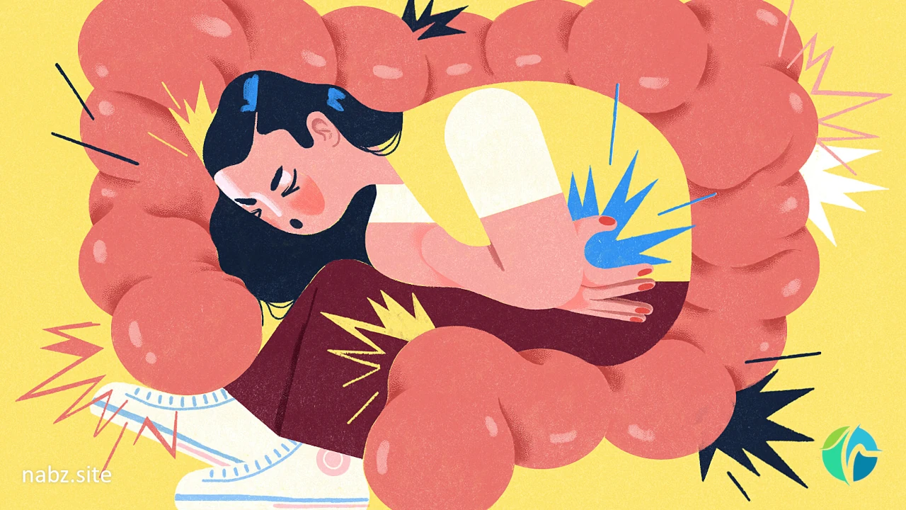  سندروم روده تحریک پذیر