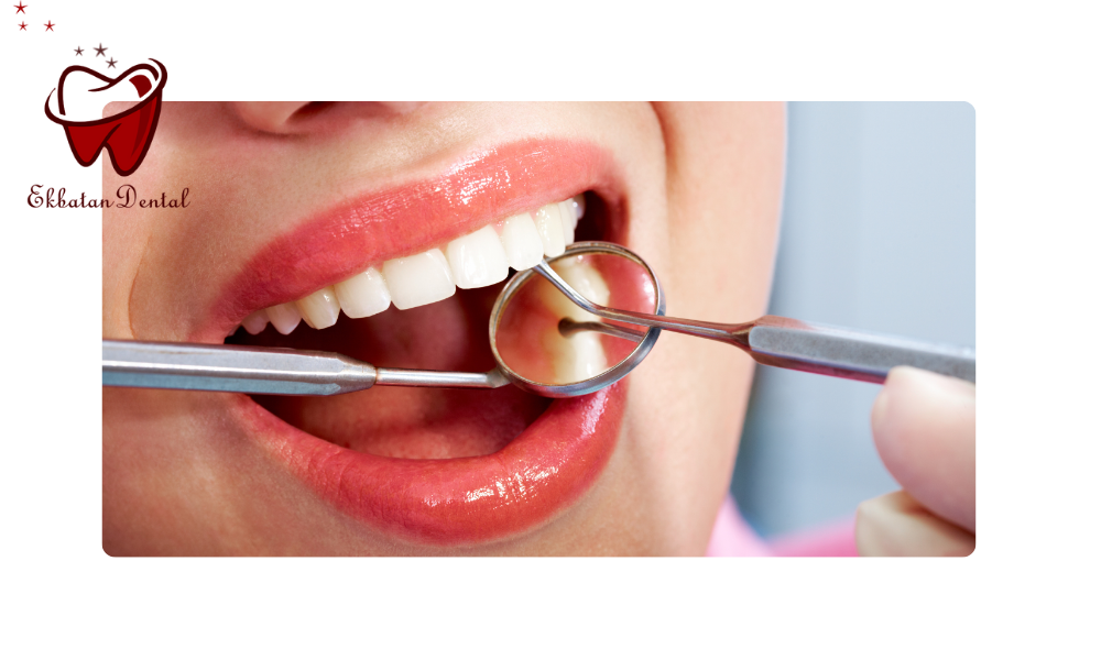 عوامل جذابیت لبخند زیبا