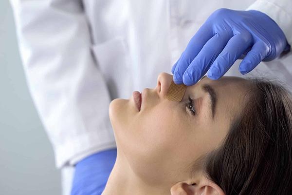 جراحی زیبایی بینی با روش باز برای رفع قوز و تغییرات گسترده