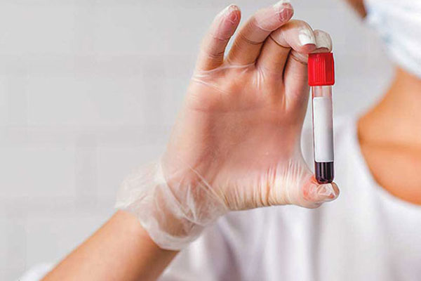 آزمایش‌های بیماری‌های مقاربتی