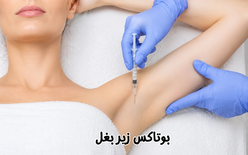بوی بد زیر بغل را چگونه درمان کنیم؟ علتها، راهکارها و درمانهای مؤثر 3 بوتاکس زیر بغل